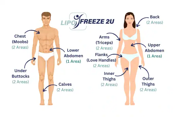 Areas you can have fat freezing treatment Reading