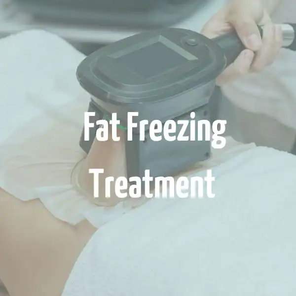 fat freezing treatment Reading