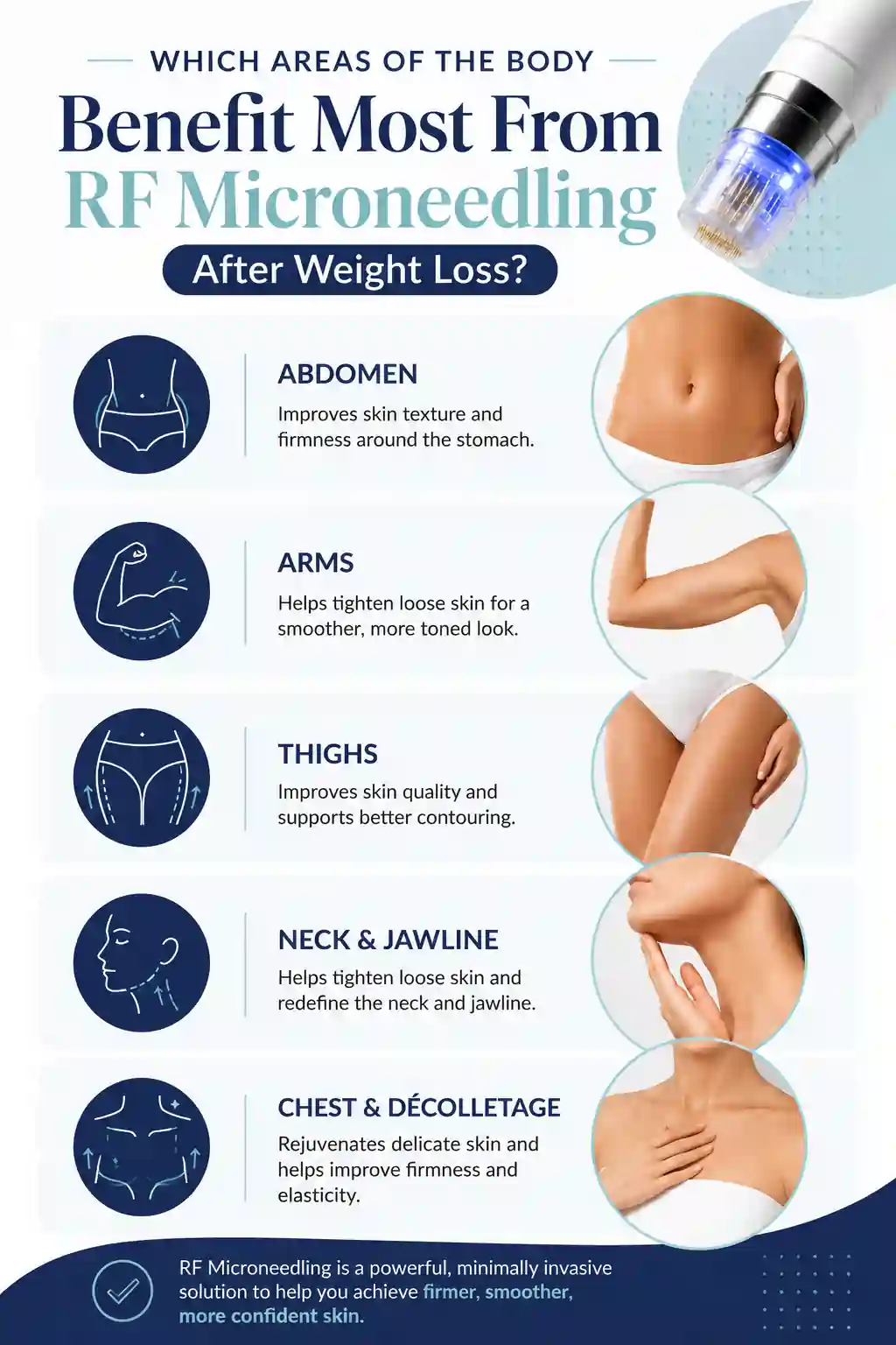 Which Areas of the Body Benefit Most From RF Microneedling After Weight Loss Reading